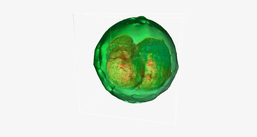 Widefield 3d Tomography - Phi Optics Inc., transparent png download