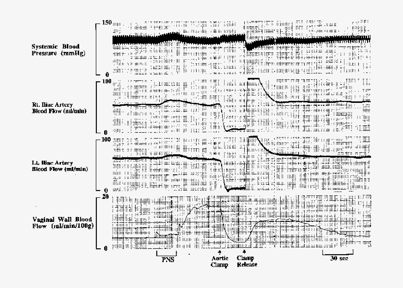 Effect Of Mechanical Aortic Occlusion On Vaginal Wall - Aorta, transparent png download