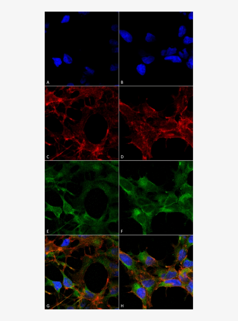 Smc 505 Acrolein Antibody 10a10 Icc If Human Embryonic - Hek 293 Cells, transparent png download