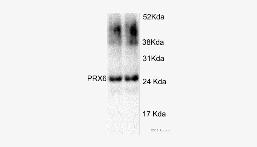 Anti-peroxiredoxin 6 Antibody - Prdx6, transparent png download