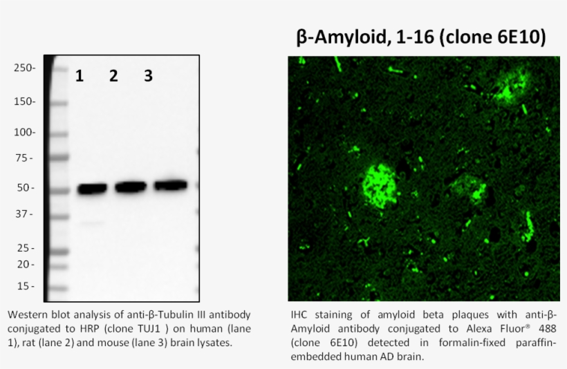 Anti Beta Amyloid 1 42 Western Blot, transparent png download