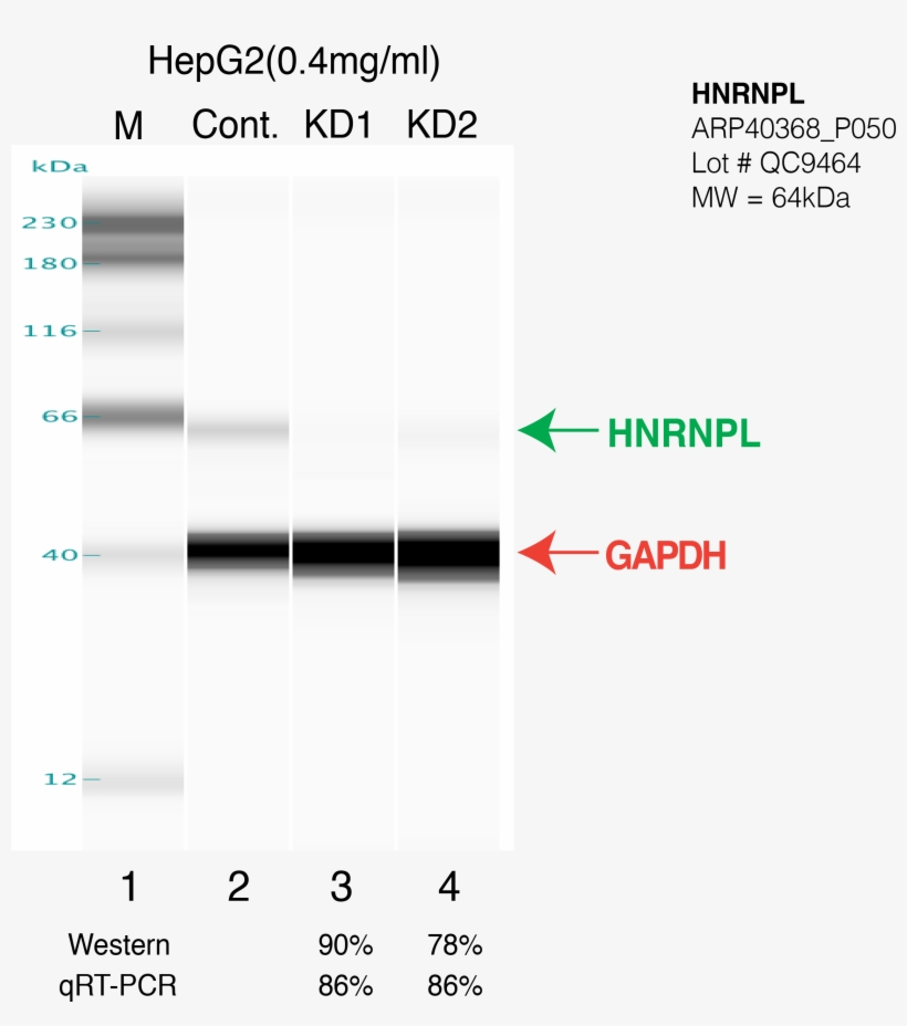 Hnrnpl Hepg2 Fu's - Comme Des Garcons, transparent png download