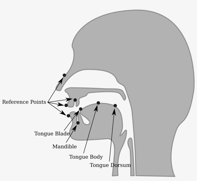 Ema Coil Placement2 - Cartoon, transparent png download