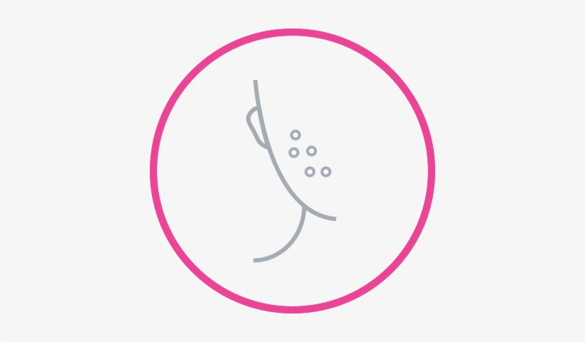 Acne Solutions - Rejuvenation, transparent png download