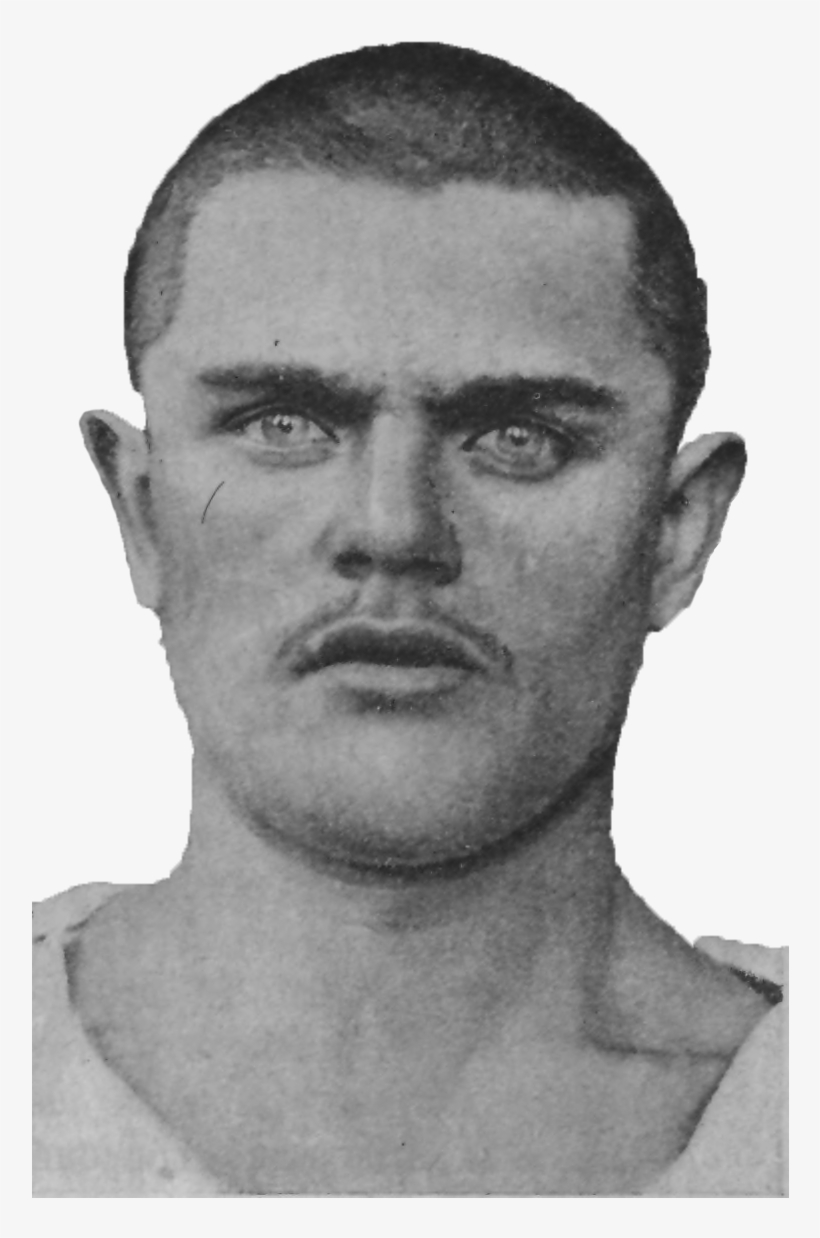 Epilepsy, Age 20 - Wikimedia Commons, transparent png download