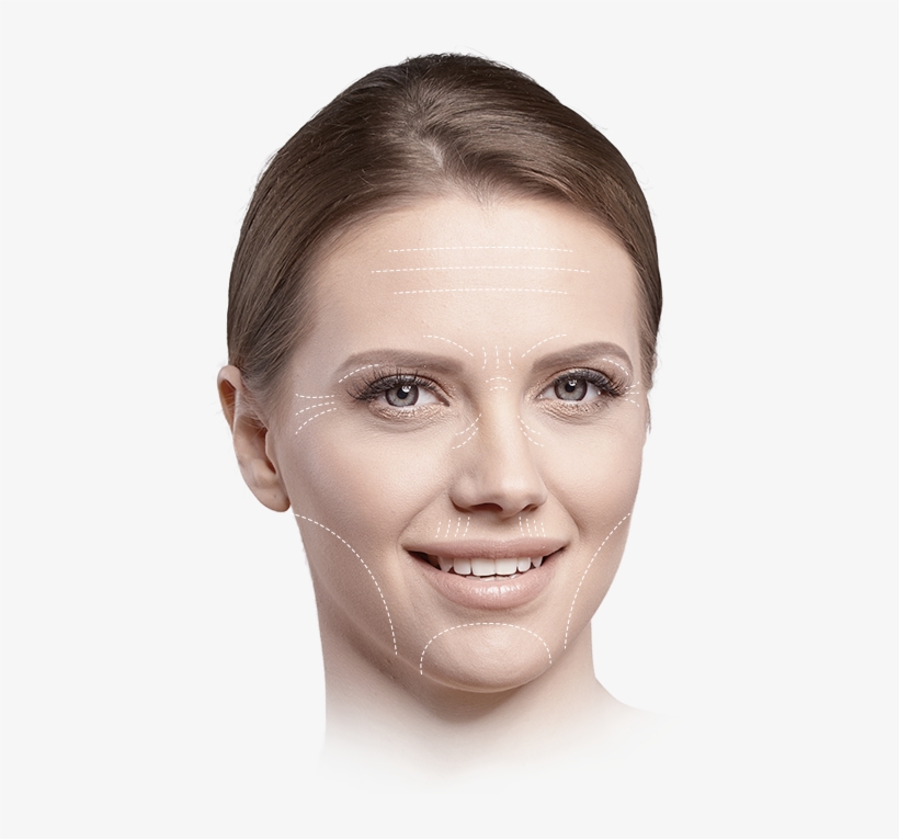 Vertical Lip Lines - Lip Therapy With Filler In Australia, transparent png download