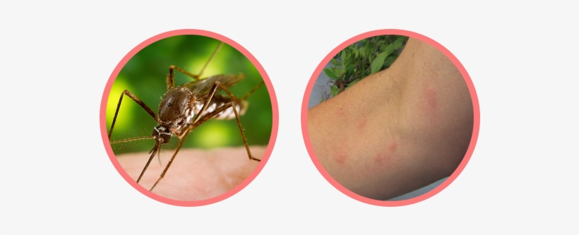 Mosquitoes Teeny, Tiny, Silent Disease-carriers - Mosquito, transparent png download