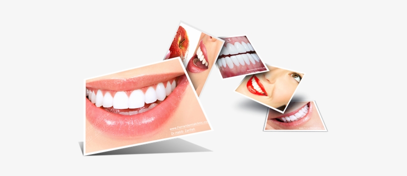 Habib Zarifeh Clinic, Our Elite Team Of Doctors Is - Dental Smile Images Png, transparent png download