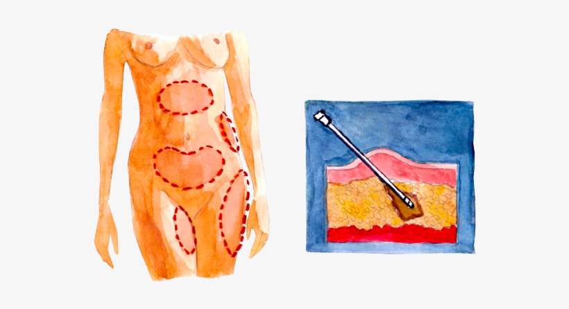 Viksraitis, transparent png download