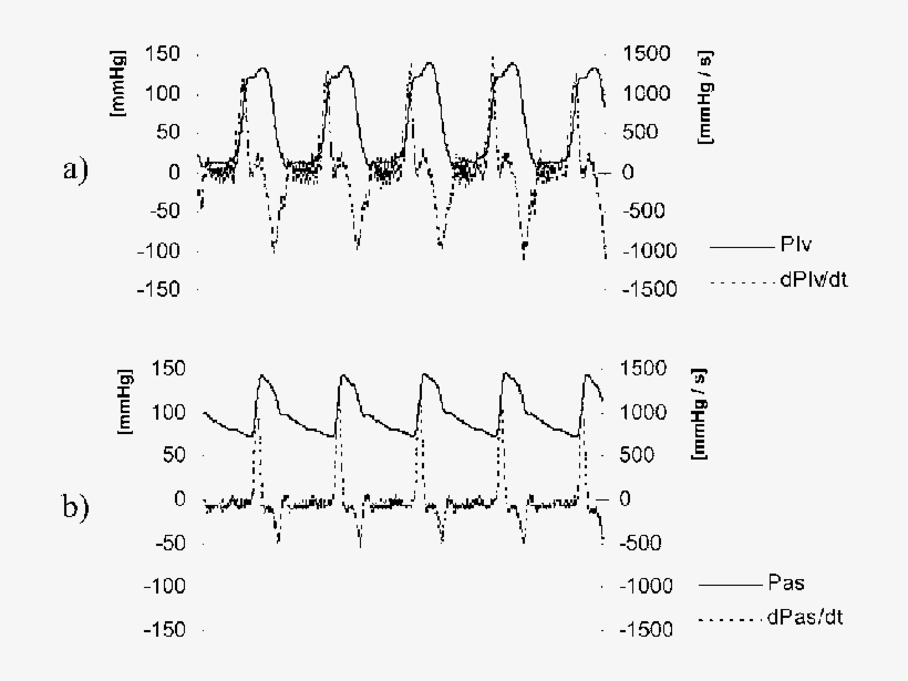 A) Left Ventricular Pressure (plv) And Its Dime Derivative; - Handwriting, transparent png download