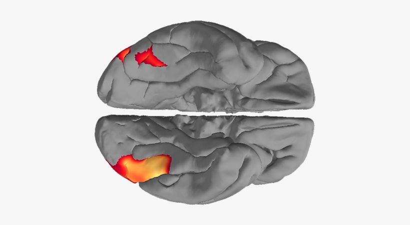 Fmri Scan Of An Average Human Brain - Skull, transparent png download