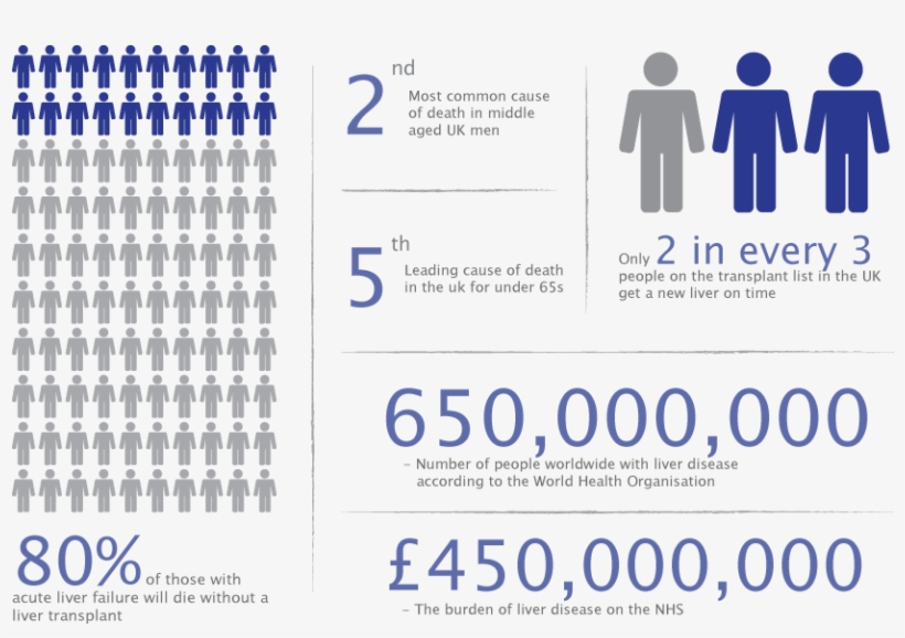 Every Year In The Uk More Than Three Thousand People - Liver Transplant Infographic Uk, transparent png download