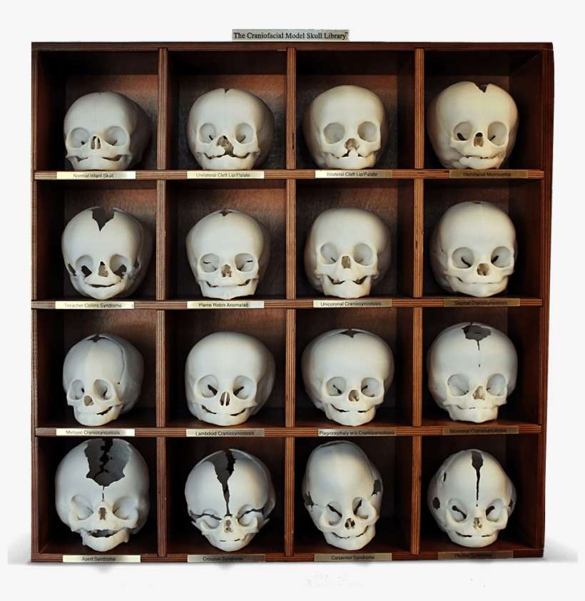 3d Systems Healthcare Craniofacial Model Skull Library - Mumbai, transparent png download