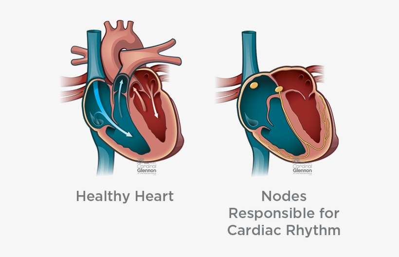 How Is It Monitored And Treated During And After Pregnancy - Hypoplastic Right Heart Syndrome, transparent png download