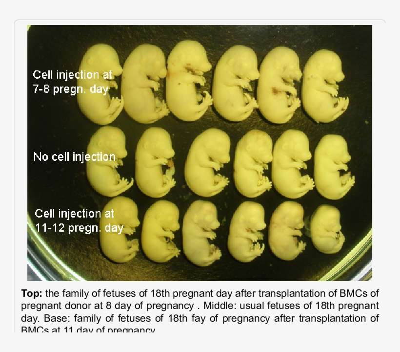 Fetuses Of 18th Day Of Pregnancy - Pregnancy, transparent png download