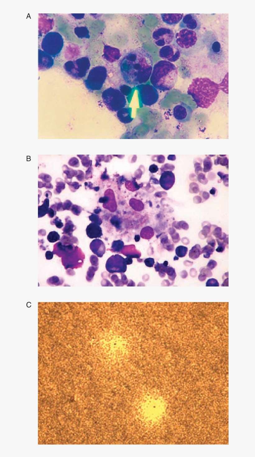Light Microscope Image Showing Macrophages Phagocytizing - Neutrophils Phago, transparent png download