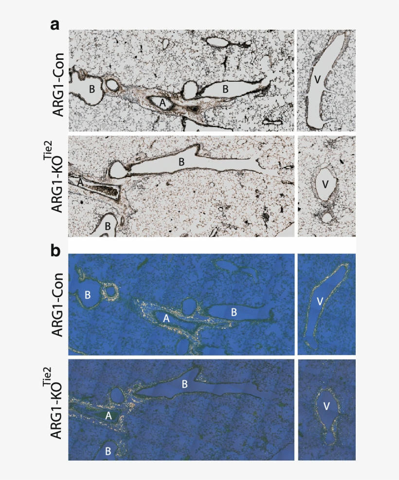 Effect Of Arg1 Ablation On Lung Remodeling - Tek Tyrosine Kinase, transparent png download