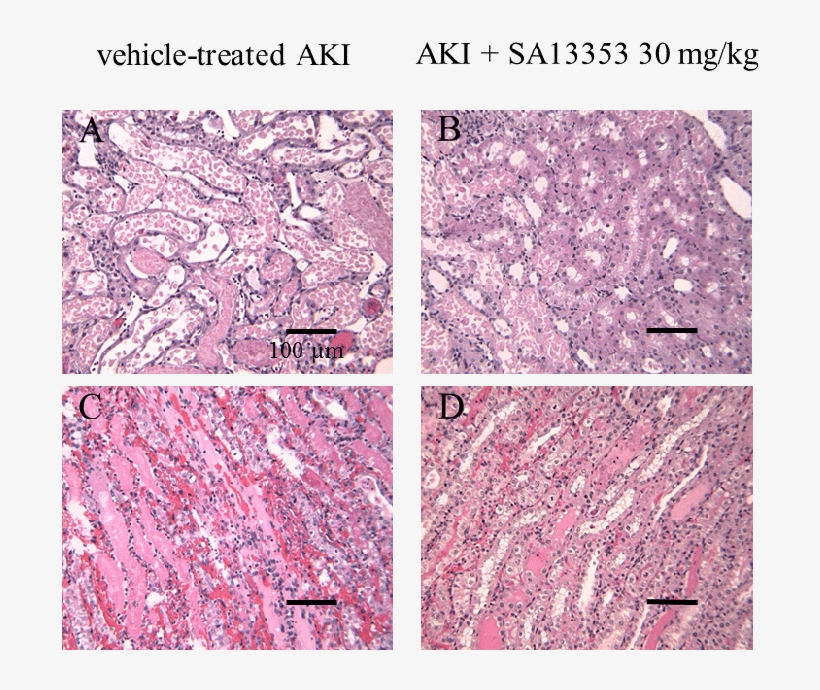 Light Microscopy Of The Outer Zone Outer Stripe And - Marble, transparent png download