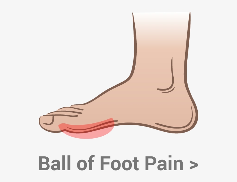 Heel Pain, transparent png download