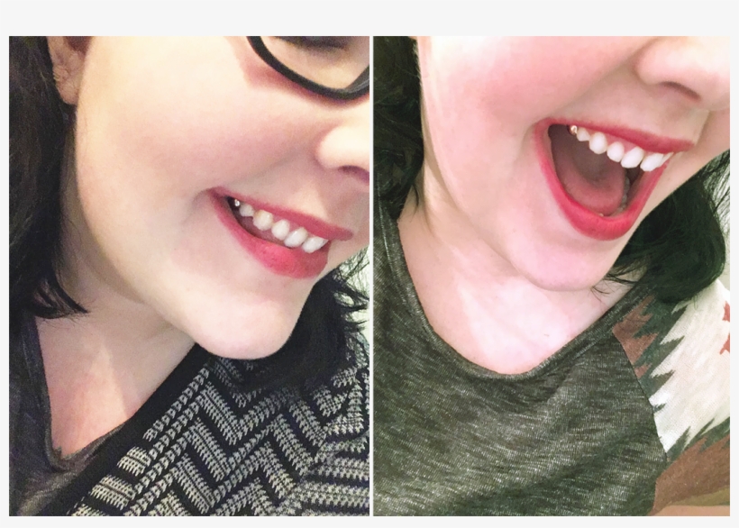 The Truth Is Gold Tooth Or No Gold Tooth, I'm Not By - People With A Gold Tooth, transparent png download