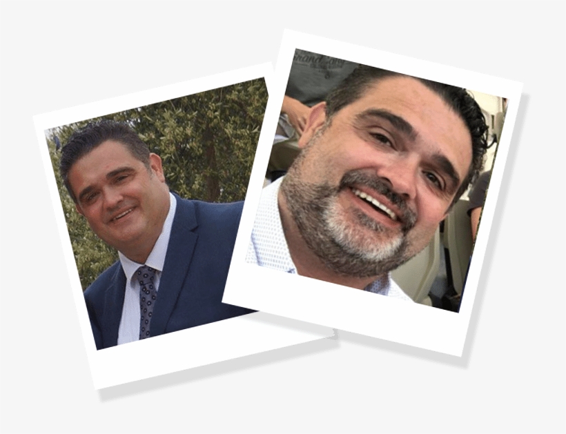 Gastric Band Surgery Is No “quick Fix” - Archive, transparent png download