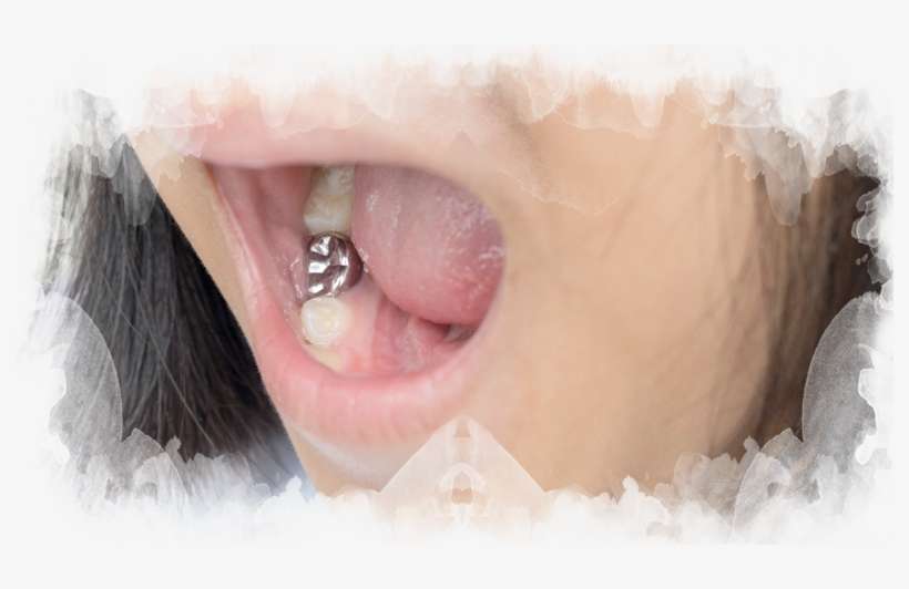 Stainless Steel Crowns - Stainless Steel, transparent png download