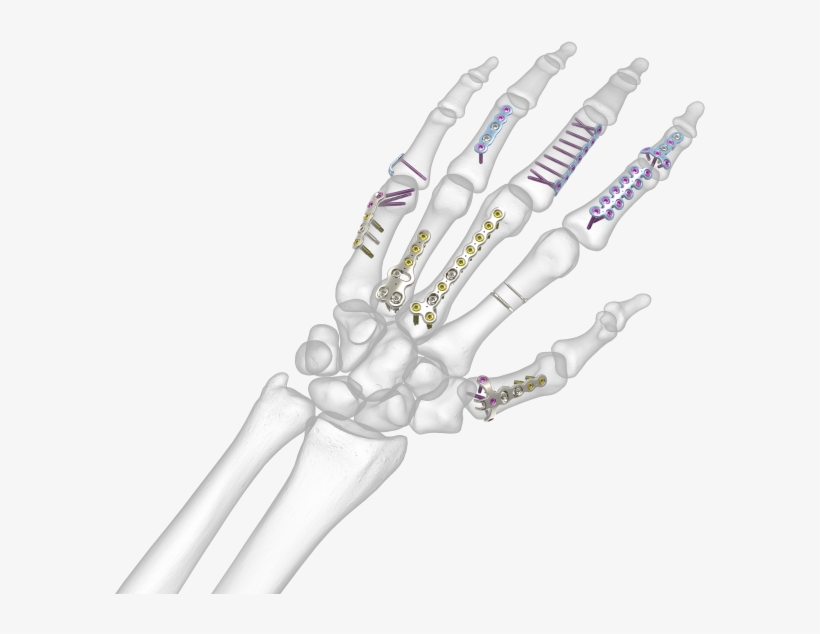 See All Images - Bone Hand, transparent png download