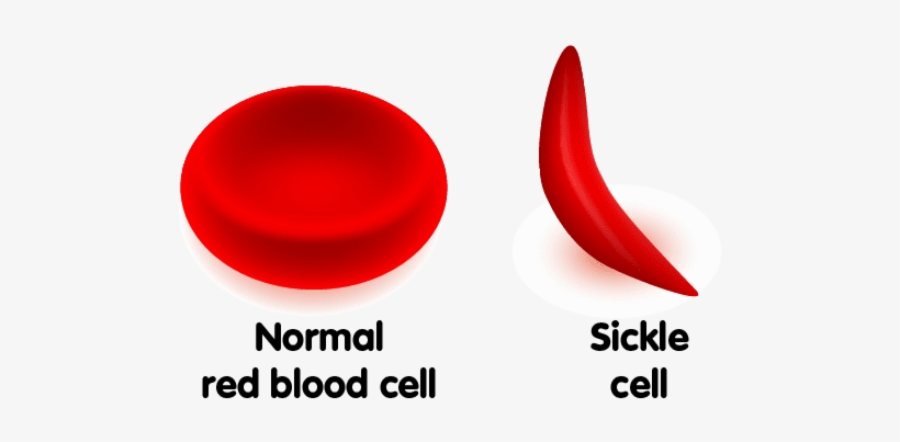 Fast Facts About African-american Blood Donation - Kansas City, transparent png download