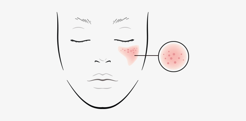 Light Beams Hinder Sebum Production And Imporoves Skin - Cible De Tir A Imprimer, transparent png download