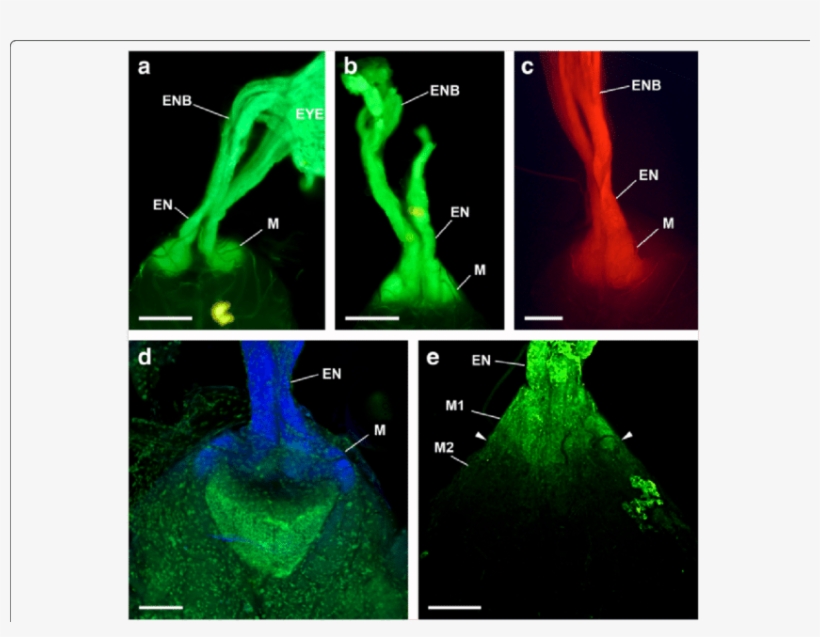 Dio And Dii (c) Labelling Via Both Eyes Of Opilio Canestrinii - Eye, transparent png download