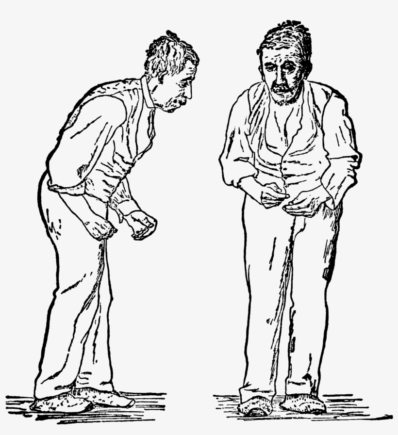 Paralysis Agitans - Parkinsons Disease, transparent png download