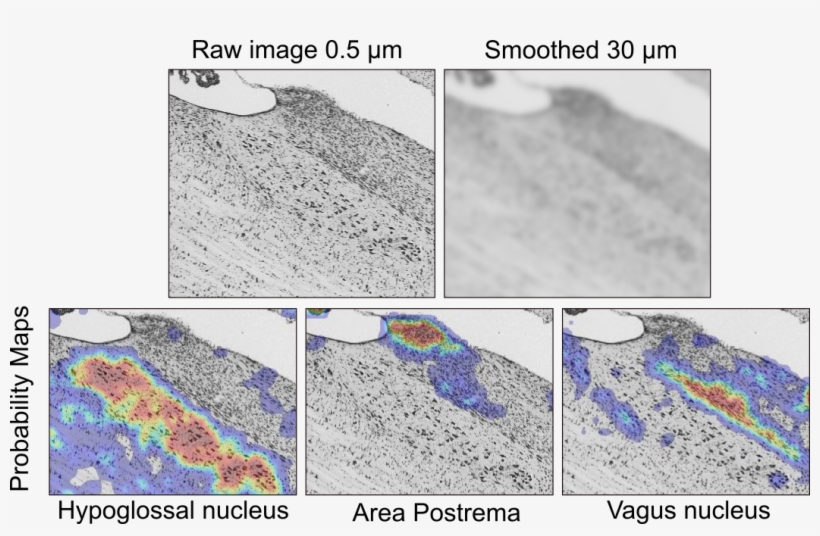 Based On Automated Registration Of Twelve Specimens, - Map, transparent png download