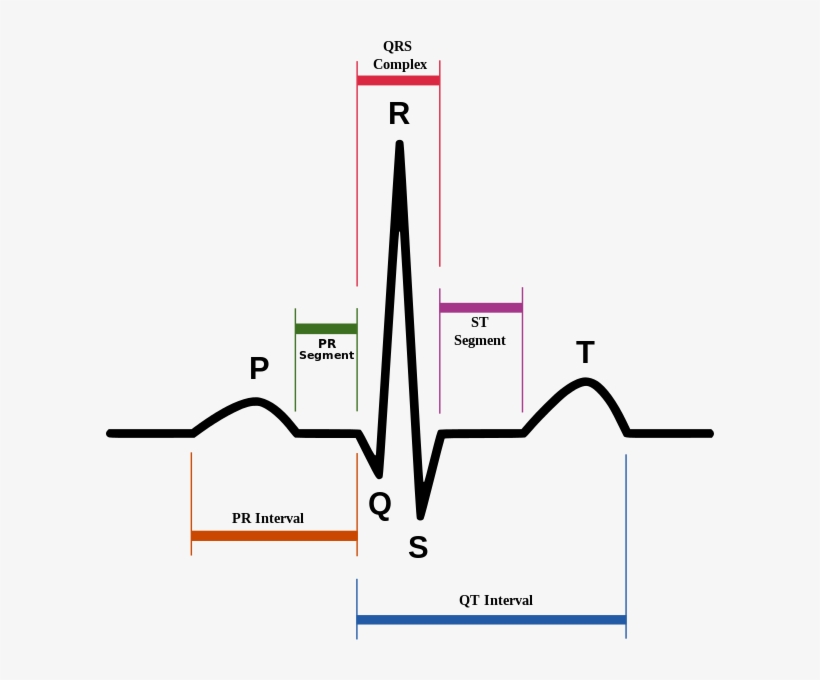 File Sinusrhythmlabels Svg Nursing Pinterest Explore - Qt Interval, transparent png download