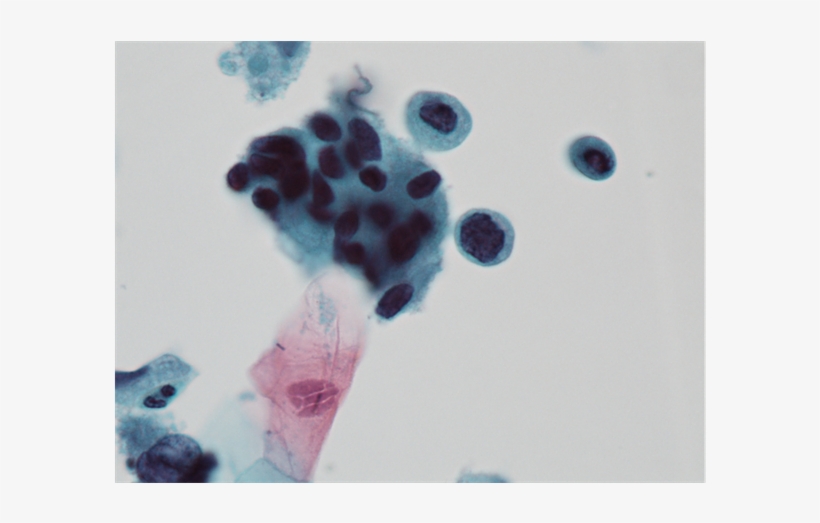 Preparation Showing Rounded Cells With Single Dyskariotic - Visual Arts, transparent png download