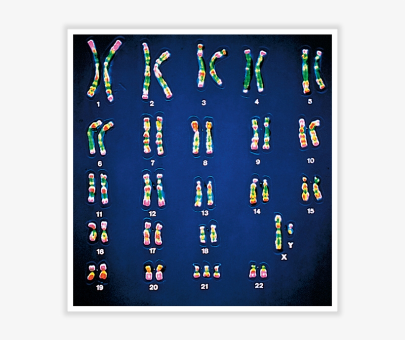 44 Am 121768 5bjciozma5d Sl272shp17 80 Dx902 Dy902 - Williams Syndrome Chromosome Chart, transparent png download