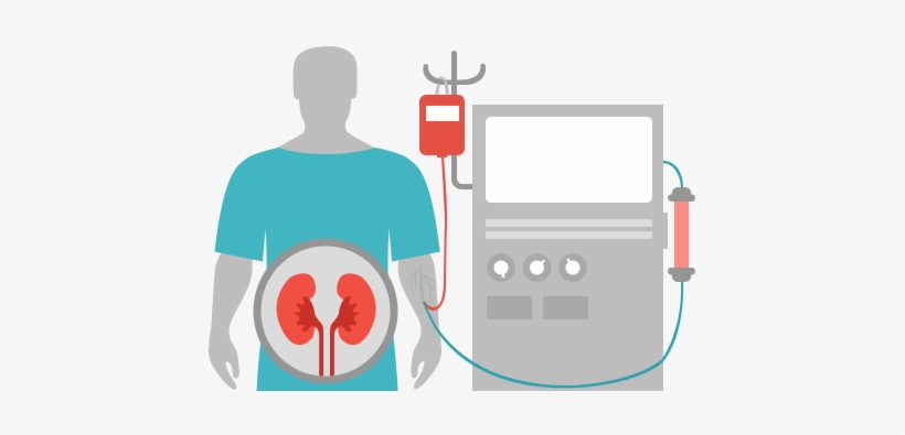Chronic Kidney Failure - Hemodiyaliz Diyaliz, transparent png download