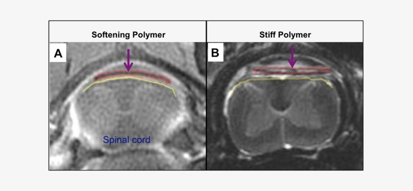 Advanced Materials For Safe And Effective Stimulation - Spinal Cord, transparent png download