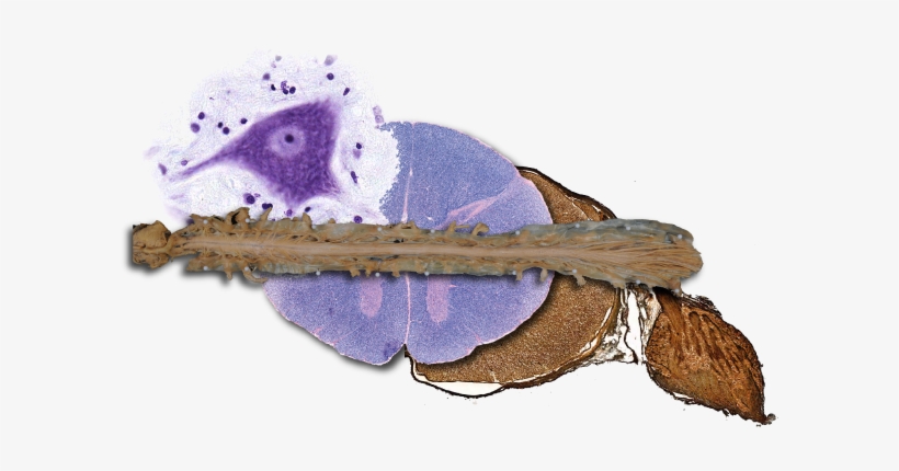The Spinal Cord Is A Ventral Extension Of The Brainstem - Pyrrharctia Isabella, transparent png download