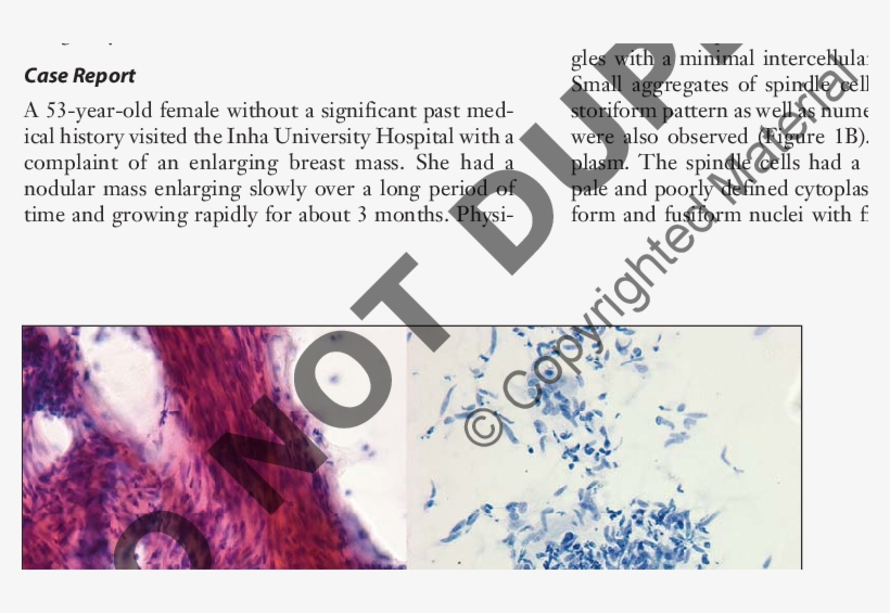 Large Tissue Fragments Display Parallel Rows Or Fascicular - Fine-needle Aspiration, transparent png download
