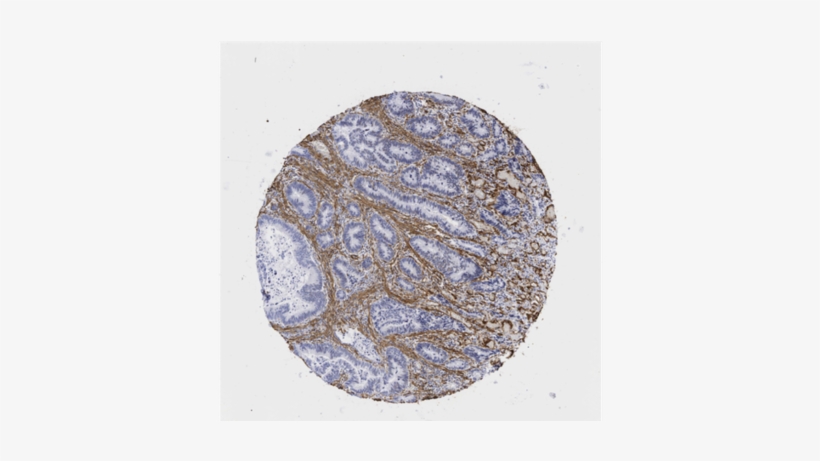 Article Update 08e51ce6 Affe 4b2c 8bfc Aa0fd4b3b125 - Cobblestone, transparent png download