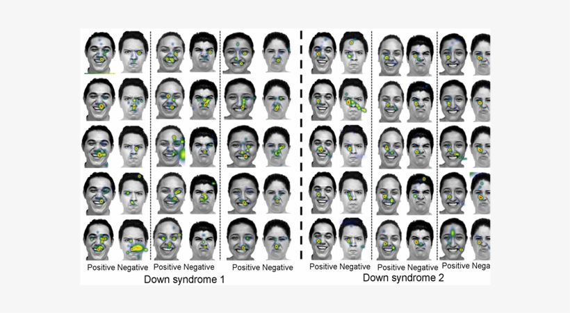 Male Ds Eye Fixation Time Compared To A Ds Female Eye - Poster, transparent png download