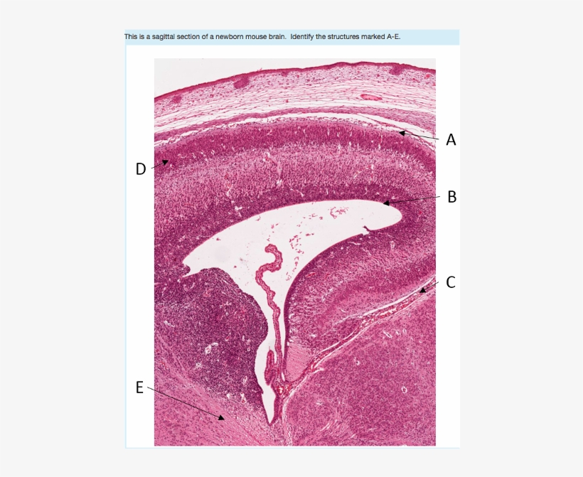 Choose - Sagittal Plane, transparent png download