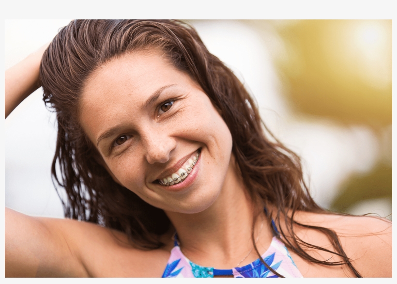 Adult Orthodontics - Orthodontics, transparent png download