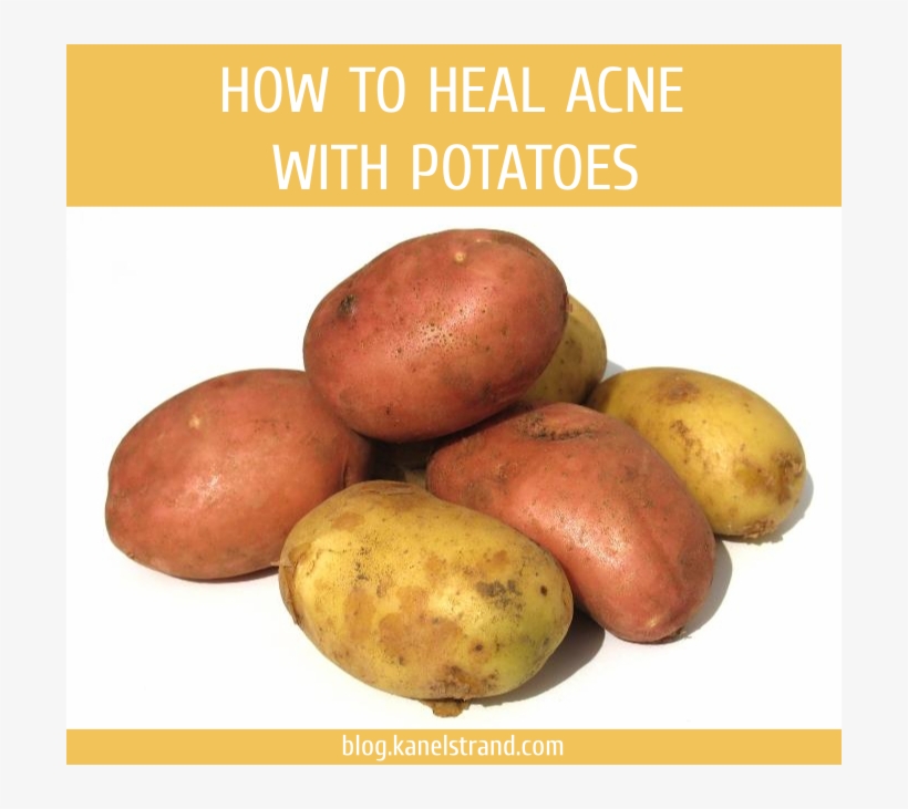 How To Heal Acne With Potatoes - Few Potatoes, transparent png download