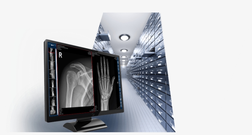 Dicom Cloud Orca - Lcd Tv, transparent png download