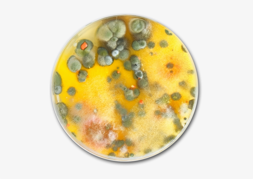 Billion In Annual Repair Costs For Moisture And Mold - Mold Petri Dish Png, transparent png download