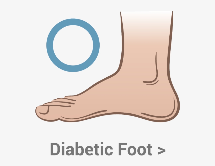 Diabetes Can Have A Significant Effect On Your Feet - Foot, transparent png download