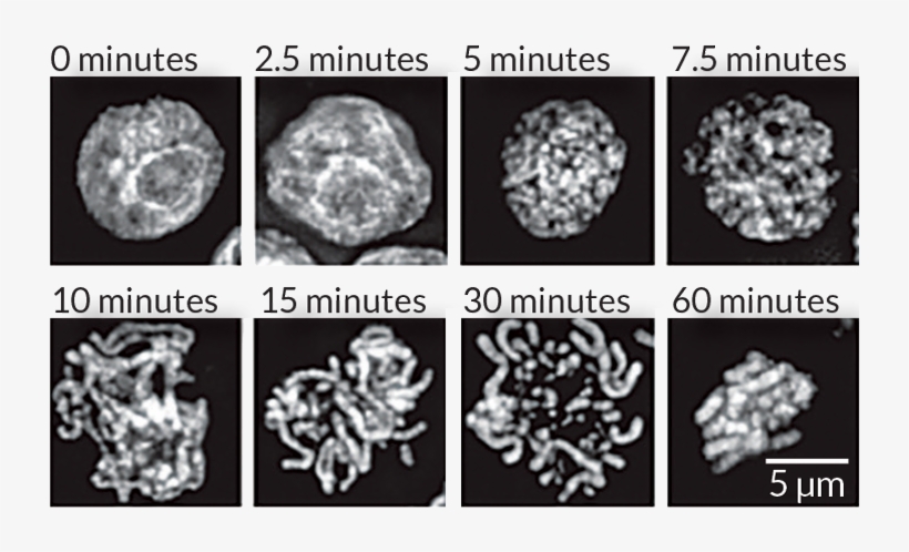 Citations - Computed Tomography, transparent png download