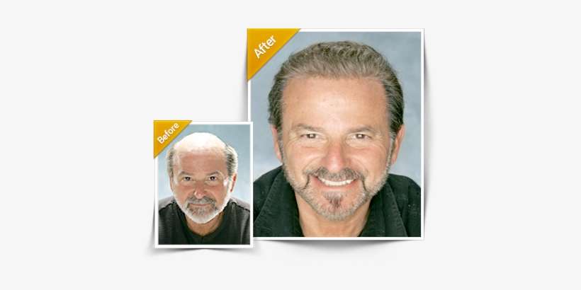 Hairpieces For Men - Hair Piece Before And After, transparent png download