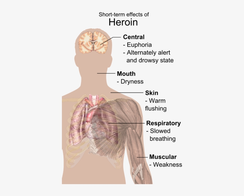 Short-term Effects Of Heroin - Heroin Effects, transparent png download